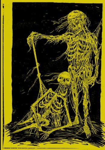 Hyperdontia, Helak, Septage Konseri